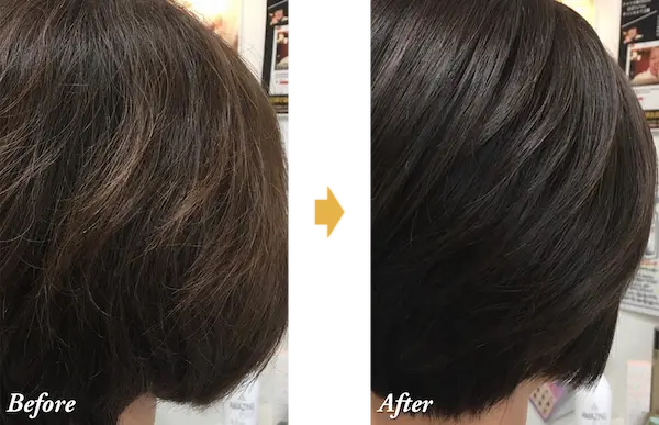 施術前と後での違い