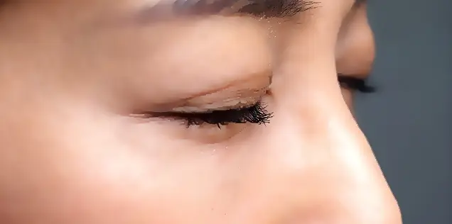 目シワ