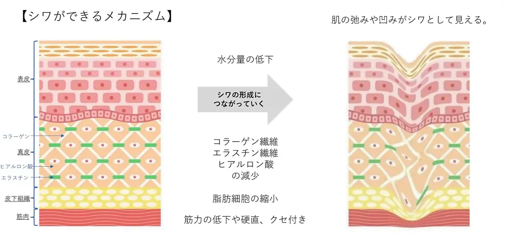しわが出来るメカニズム
